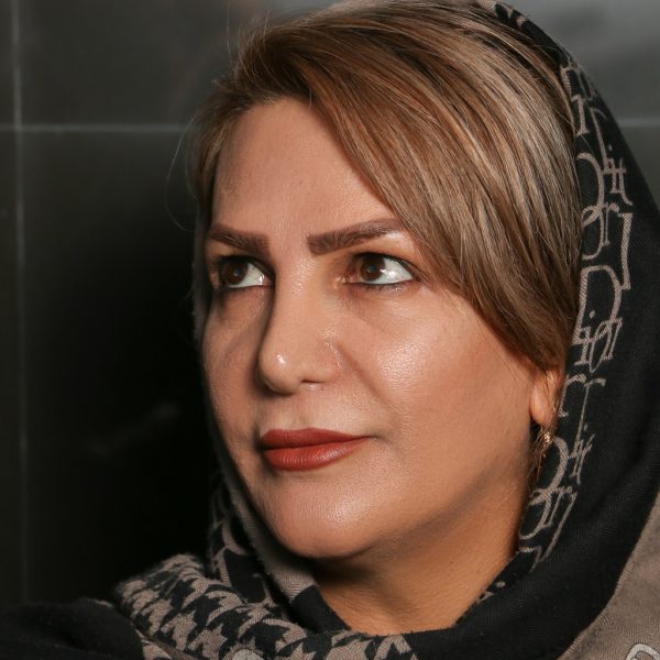 فیلر زیر چشم