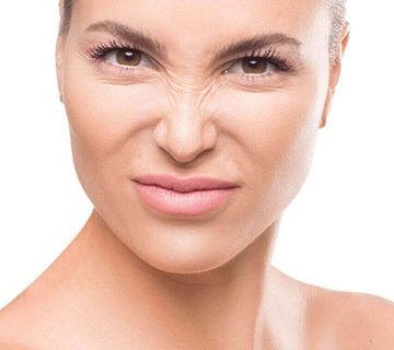 بوتاکس خطوط خرگوشی