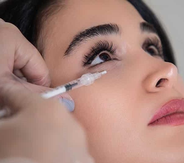 مزوتراپی زیر چشم