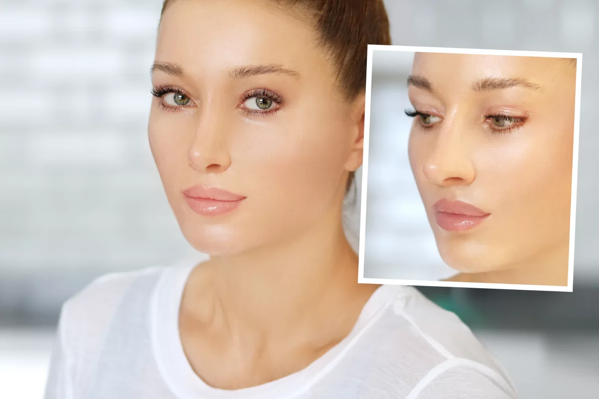 اصلاح بینی بدون جراحی
