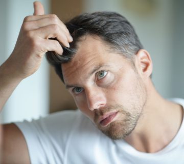 آیا کمبود آهن باعث ریزش مو می شود؟