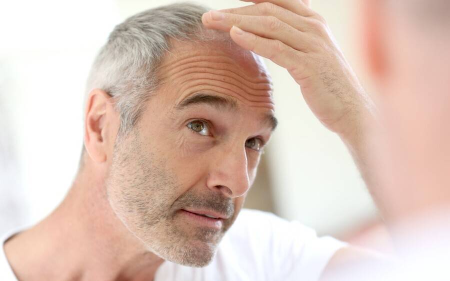 ریزش مو و سلامت کلی بدن