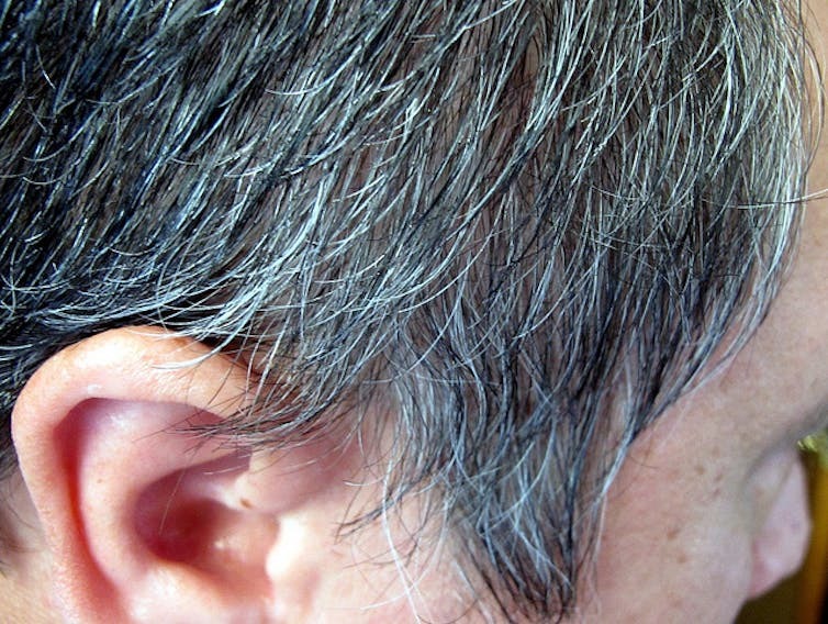 علت خاکستری شدن مو